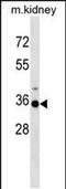 Homeobox A3 antibody, PA5-48830, Invitrogen Antibodies, Western Blot image 