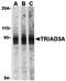 Ring Finger Protein 216 antibody, orb74563, Biorbyt, Western Blot image 