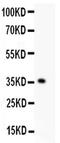 Kruppel Like Factor 6 antibody, PA5-79560, Invitrogen Antibodies, Western Blot image 