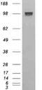 Ectonucleotide Pyrophosphatase/Phosphodiesterase 1 antibody, ab40003, Abcam, Western Blot image 