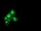 Catalase antibody, NBP2-00492, Novus Biologicals, Immunocytochemistry image 