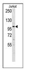 DNA Methyltransferase 3 Alpha antibody, AP11051PU-N, Origene, Western Blot image 