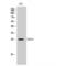 Killer Cell Lectin Like Receptor K1 antibody, LS-C382539, Lifespan Biosciences, Western Blot image 