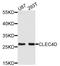 C-Type Lectin Domain Family 4 Member D antibody, LS-C332220, Lifespan Biosciences, Western Blot image 