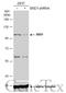 Staphylococcal Nuclease And Tudor Domain Containing 1 antibody, GTX130136, GeneTex, Western Blot image 