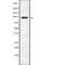 Transient Receptor Potential Cation Channel Subfamily V Member 4 antibody, abx219148, Abbexa, Western Blot image 