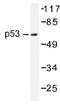 p53 antibody, AP01418PU-N, Origene, Western Blot image 