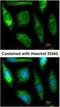 Aldehyde Dehydrogenase 1 Family Member A1 antibody, PA5-34623, Invitrogen Antibodies, Immunofluorescence image 