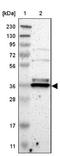 Transmembrane BAX Inhibitor Motif Containing 1 antibody, NBP1-81310, Novus Biologicals, Western Blot image 