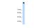 Transient Receptor Potential Cation Channel Subfamily M Member 3 antibody, A04498, Boster Biological Technology, Western Blot image 