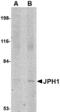 Junctophilin 1 antibody, LS-C82882, Lifespan Biosciences, Western Blot image 