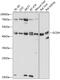 Glutaryl-CoA Dehydrogenase antibody, GTX66552, GeneTex, Western Blot image 