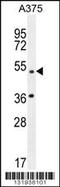 Adaptor Related Protein Complex 1 Subunit Mu 1 antibody, TA324464, Origene, Western Blot image 