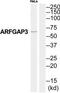 ADP Ribosylation Factor GTPase Activating Protein 3 antibody, TA315323, Origene, Western Blot image 