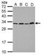 Proteasome Activator Subunit 1 antibody, PA5-31173, Invitrogen Antibodies, Western Blot image 