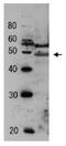 General Transcription Factor IIF Subunit 2 antibody, GTX64184, GeneTex, Western Blot image 