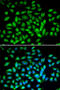 Methyl-CpG Binding Protein 2 antibody, 14-922, ProSci, Immunofluorescence image 