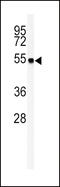 Glutamic-Oxaloacetic Transaminase 1 antibody, MBS9203497, MyBioSource, Western Blot image 