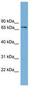 Interferon-activable protein 204 antibody, TA341783, Origene, Western Blot image 