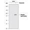 RAD17 Checkpoint Clamp Loader Component antibody, MAB1374, R&D Systems, Western Blot image 