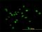 NUAK Family Kinase 1 antibody, H00009891-B01P, Novus Biologicals, Immunofluorescence image 