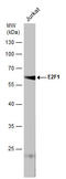 E2F-1 antibody, GTX70163, GeneTex, Western Blot image 