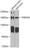 Trinucleotide Repeat Containing Adaptor 6A antibody, A04293, Boster Biological Technology, Western Blot image 