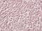 T-cad antibody, A01986, Boster Biological Technology, Immunohistochemistry frozen image 