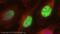 Protein Arginine Methyltransferase 1 antibody, ab73246, Abcam, Immunofluorescence image 