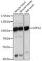 Coatomer Protein Complex Subunit Gamma 2 antibody, A15817, ABclonal Technology, Western Blot image 