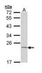 TNF Alpha Induced Protein 8 antibody, GTX111940, GeneTex, Western Blot image 