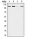 Apolipoprotein B antibody, LS-C667708, Lifespan Biosciences, Western Blot image 