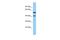 Von Willebrand Factor C Domain Containing 2 antibody, A15677, Boster Biological Technology, Western Blot image 