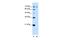 Ring Finger Protein 168 antibody, PA5-42362, Invitrogen Antibodies, Western Blot image 