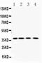 Purine Nucleoside Phosphorylase antibody, PA5-79839, Invitrogen Antibodies, Western Blot image 