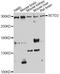 SET Domain Containing 2, Histone Lysine Methyltransferase antibody, A3194, ABclonal Technology, Western Blot image 
