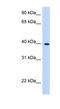 Lipoic Acid Synthetase antibody, NBP1-54320, Novus Biologicals, Western Blot image 