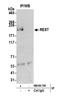RE1 Silencing Transcription Factor antibody, NB100-756, Novus Biologicals, Western Blot image 
