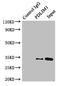 Cyclin Dependent Kinase 2 antibody, A62242-100, Epigentek, Western Blot image 