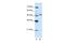Zinc Finger Protein 296 antibody, A18233, Boster Biological Technology, Western Blot image 