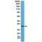MYD88 Innate Immune Signal Transduction Adaptor antibody, M00025-1, Boster Biological Technology, Western Blot image 