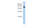 Myosin Binding Protein C, Fast Type antibody, ARP42187_P050, Aviva Systems Biology, Western Blot image 