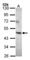 Acyl-CoA Dehydrogenase Family Member 8 antibody, LS-C185539, Lifespan Biosciences, Western Blot image 