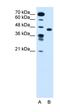 Solute Carrier Family 35 Member C1 antibody, orb325115, Biorbyt, Western Blot image 