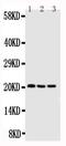 Caveolin 3 antibody, PA1523, Boster Biological Technology, Western Blot image 