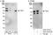 Mitogen-Activated Protein Kinase Kinase Kinase 7 antibody, A301-916A, Bethyl Labs, Western Blot image 