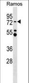 Metastasis Associated 1 Family Member 3 antibody, LS-C164658, Lifespan Biosciences, Western Blot image 
