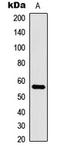 CDC Like Kinase 1 antibody, LS-C354616, Lifespan Biosciences, Western Blot image 