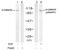 Catenin Alpha 1 antibody, GTX79145, GeneTex, Western Blot image 