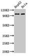 IRP1 antibody, CSB-PA001161LA01HU, Cusabio, Western Blot image 